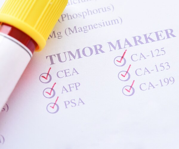cancer marker test results