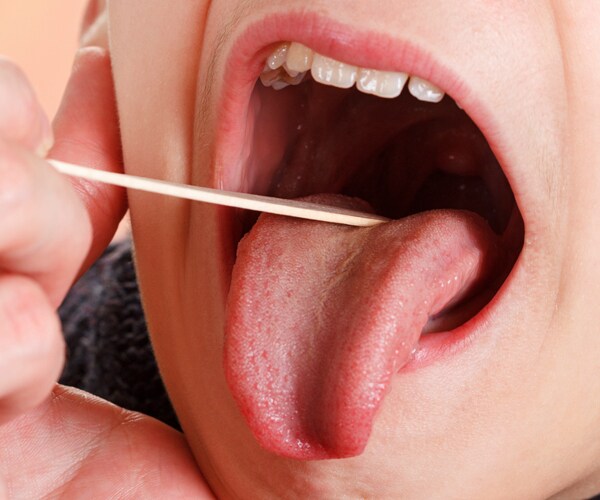 Tonsil Removal Among 17 Routine Procedures Being Dropped by UK's NHS