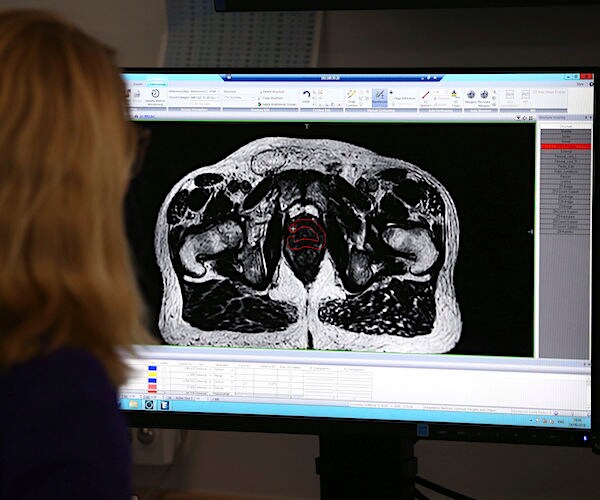 a nurse looks as a computer scan of a man's prostate to search for signs of cancer