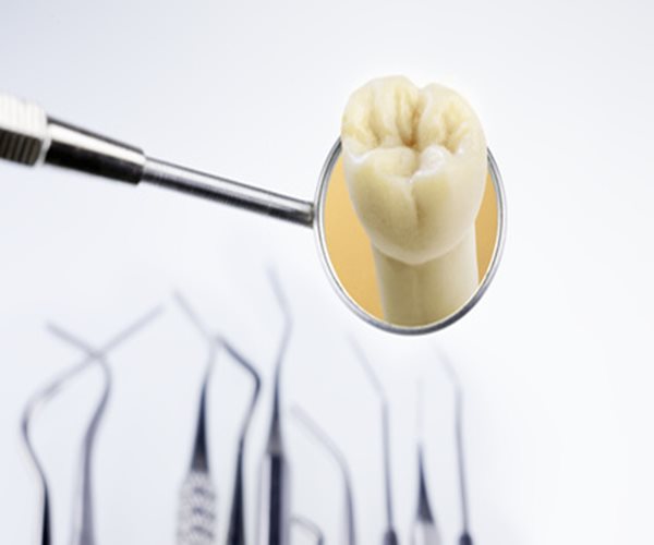 Tooth Loss Raises Risks of Physical and Mental Disability