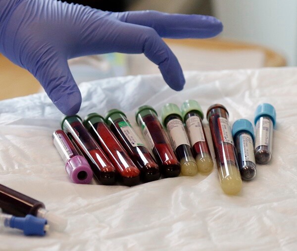 FDA Chief Outlines New Ways to Speed Cancer Drug Approvals