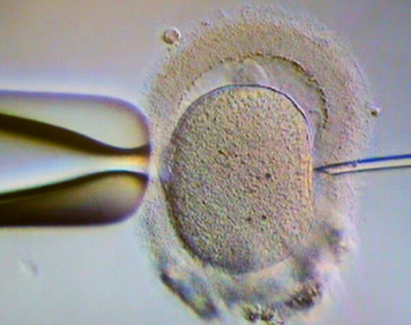 US Serial Sperm Donor Banned from Donating in Israel