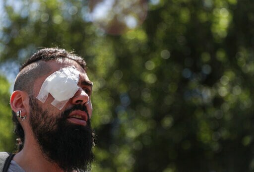 Chileans Who Lost Eyes in Protests Demonstrate in Capital