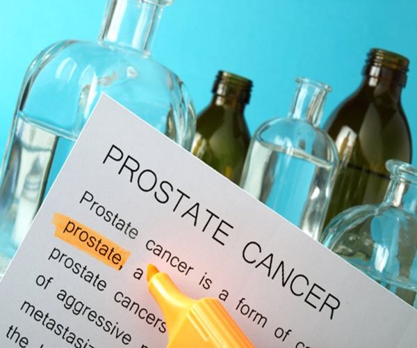 Number of Advanced Prostate Cancer Cases Soars