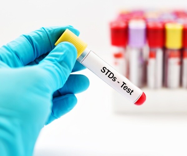 vial with blood to test for STDs