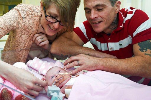 Baby's Heart Placed Back inside Her Chest in Rare Surgeries