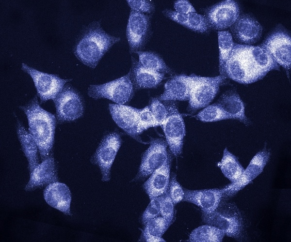 Melanoma Vaccine Plus Keytruda Effective for 3 Years