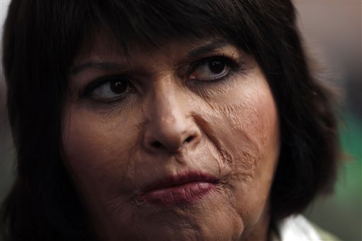 Symbol of Dictatorship Abuse, Chilean Sees Justice Coming