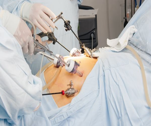 Obesity Surgery May Help Diabetics Avoid Eye, Nerve Damage