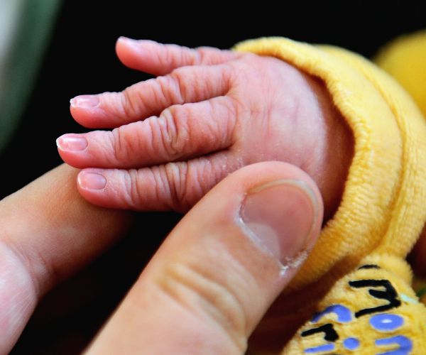 Report: Britain's 12 oz. Baby Beats Odds, Reaches 6 Months