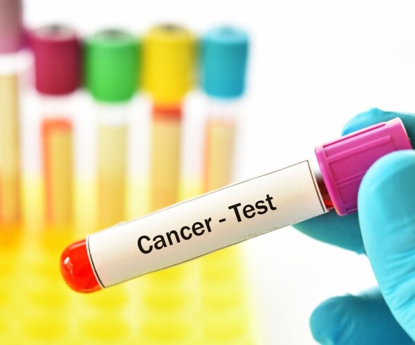 cancer blood test in vial