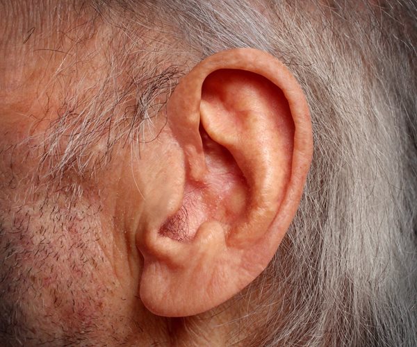 Hearing Loss Increases Risk of Dementia