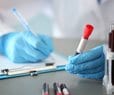 Study Determines Best Test for Tracking Cholesterol 
