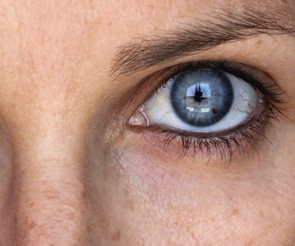 5 Ways to Reverse Skin Damage