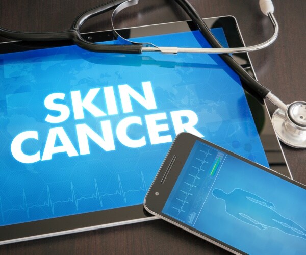 tablet with 'skin cancer' on screen, and phone with outline of man to help look for skin cancer