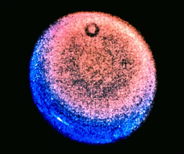 Uranus Smells Like Rotten Eggs, Scientists Say