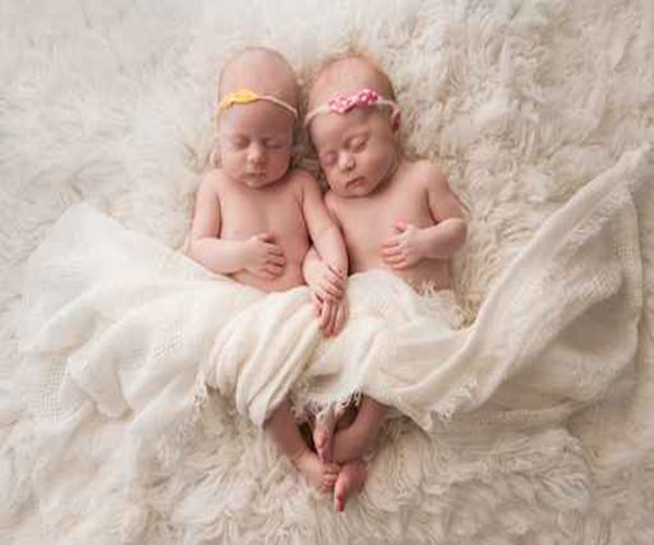 Fertility Treatments Not Linked to Twins' Birth Defects