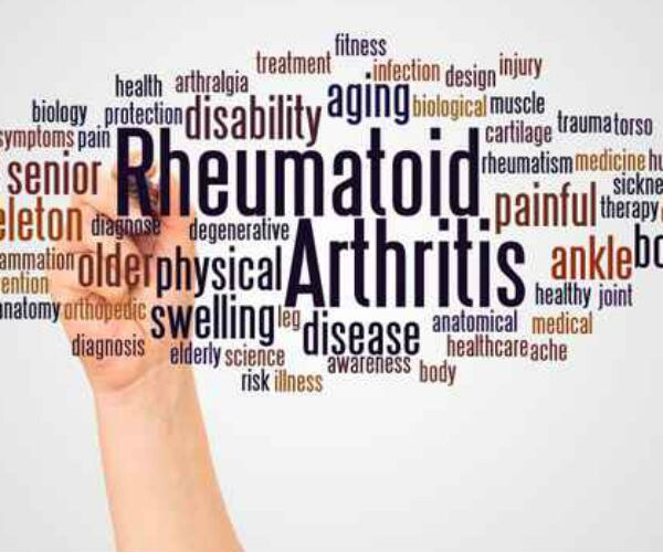 Early Warning Signs of Rheumatoid Arthritis 