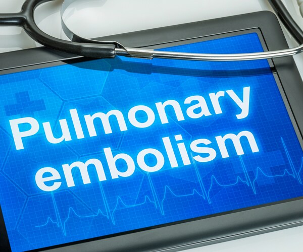 pulmonary embolism written on a tablet