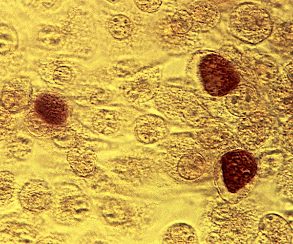 microscope image made shows Chlamydia trachomatis bacteria magnified 200 times