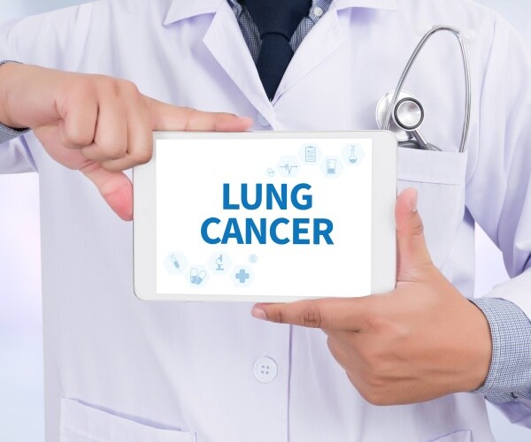 doctor holding up tablet that says "lung cancer" on the screen