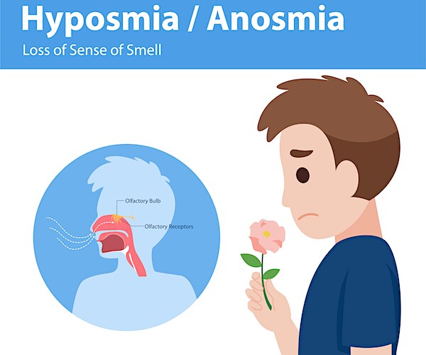 hyposmia anosmia, loss of sense of smell Info graphic elements the signs of coronavirus symptoms
