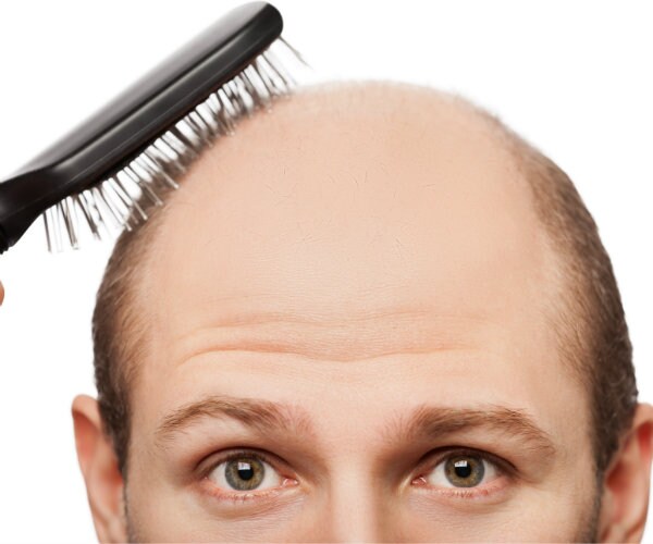 7 Drug-Free Ways to Combat Hair Loss