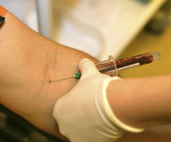 Study: Blood Test Could Spot Depression