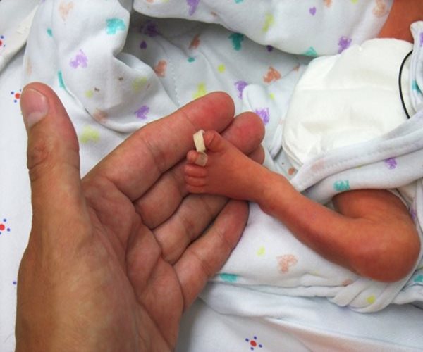 Preemies' Breathing Problems Can Linger Into Adulthood