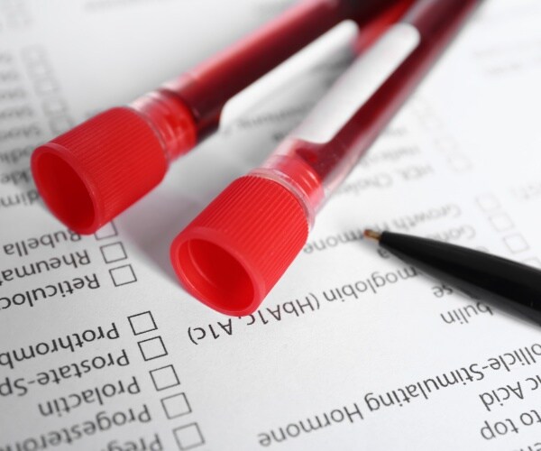 blood in vials in a lab, with forms for recording blood levels