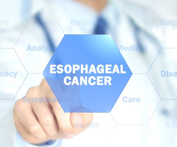 doctor touching a screen that says 'esophageal cancer' on it