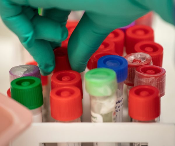 FBI: Foreign Govt Hackers Target US Coronavirus Treatment Research 