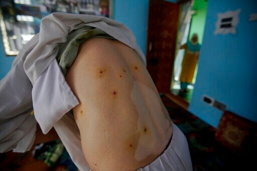 Kashmir Police Say Thousands Detained in Status-change Sweep