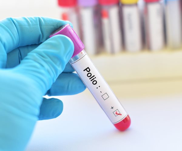 Freeze-Dried Vaccine May Rid World of Polio