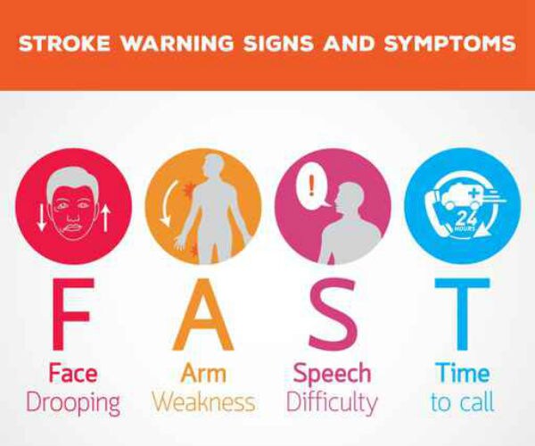graphic showing signs of a stroke