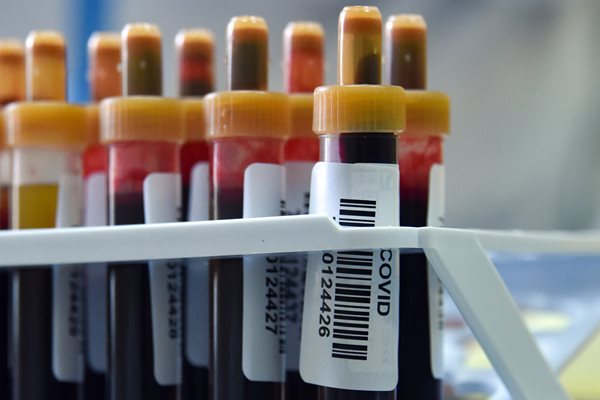vials of blood are seen in a try with bar codes