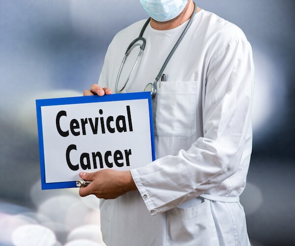 Urine Test Could Replace Painful Biopsies for Cervical Cancer
