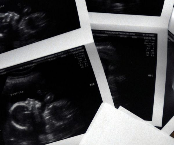 Tennessee Lawmakers Advance 6-Week Abortion Ban