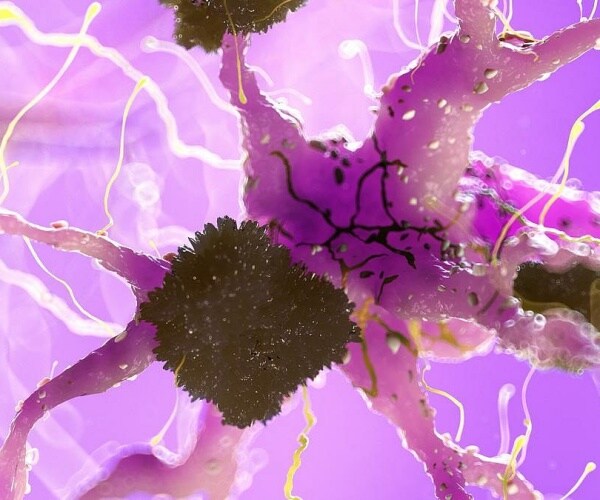 microscopic view of proteins in the brain