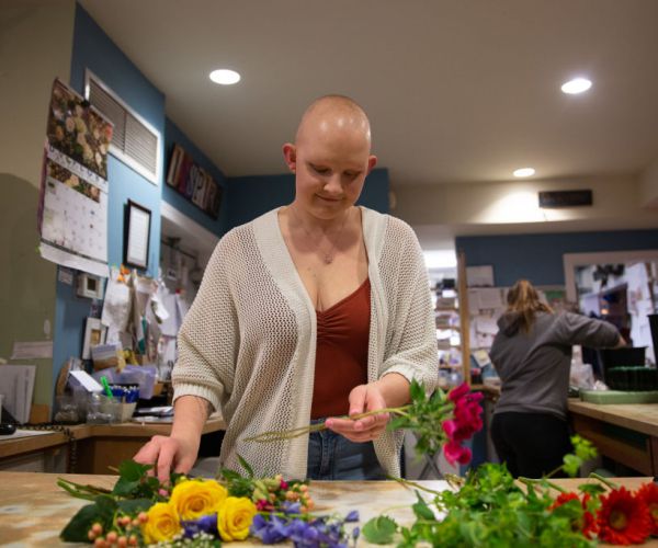 Hair Loss a Problem for Women, Too