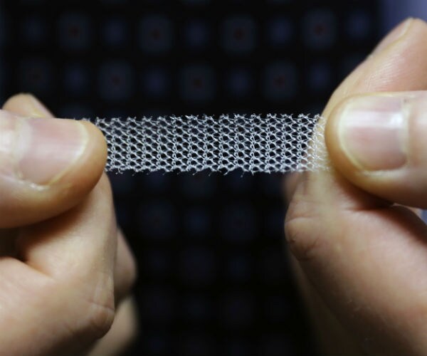 transvaginal mesh shown