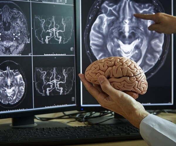 scientist holding up model of brain and pointing to an MRI scan image of brain on screen