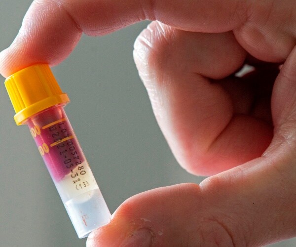 person holding a small blood sample in a tube with orange cap