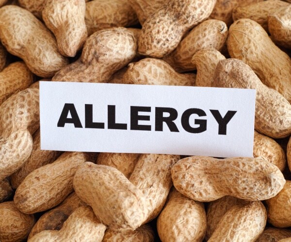 peanuts are shown with a white card with allergy written in black text