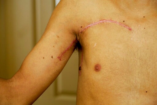 Arbitrary Arrests, Abuse the New Norm in Nicaragua