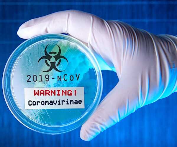 a petri dish marked coronavirus