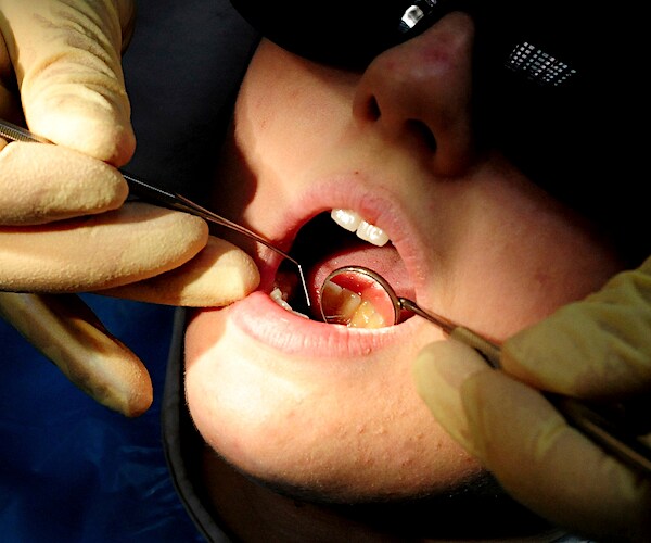 a patient sits during a dental exam