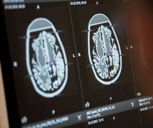 Meditation Improves Learning From Mistakes