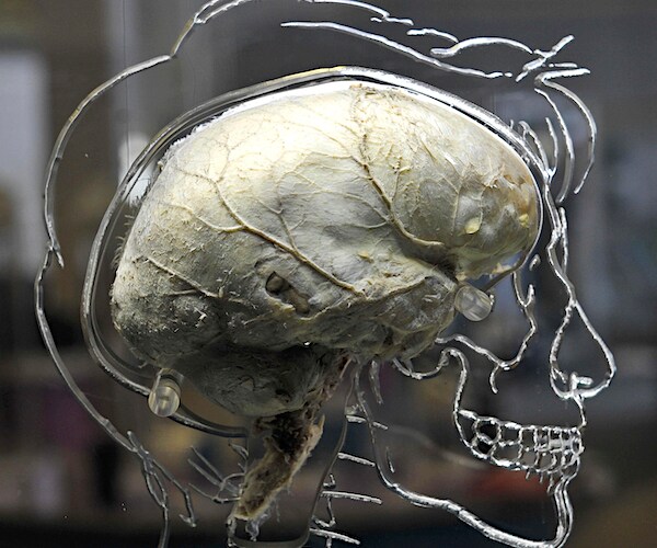 a real human brain suspended in liquid with a to-scale skeleton, central nervous system, and human silhouette