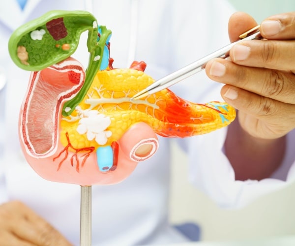 doctor pointing to cancer of pancreas